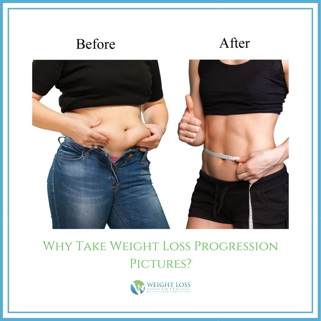 Why Take Weight Loss Progression Pictures